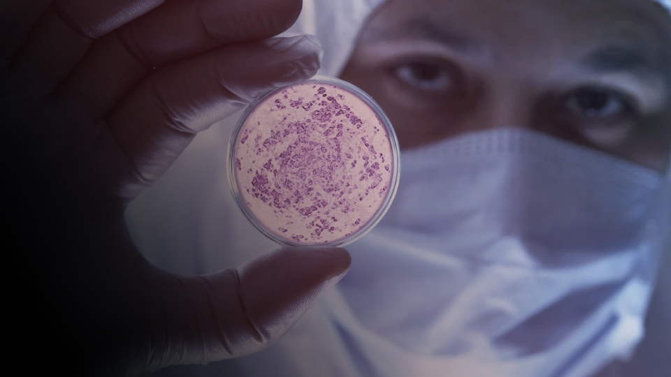 Infektionskrankheiten und klinische Mikrobiologie
