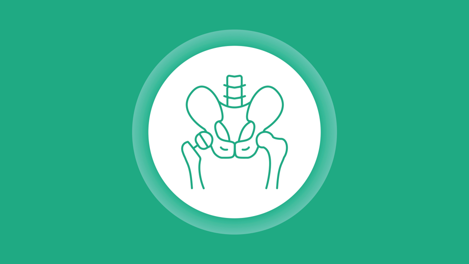 Andere Arthroplastiken