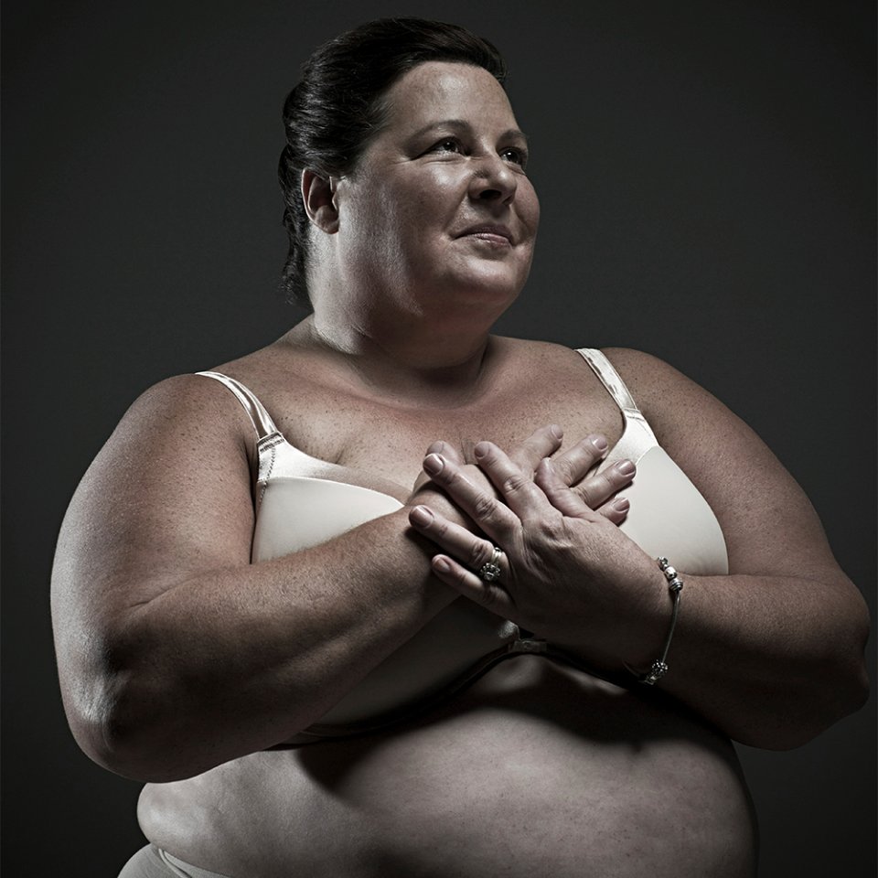 رحلتك في جراحة السمنة