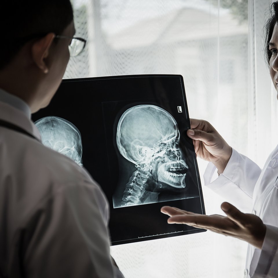 Qui est un bon candidat à la chirurgie des tumeurs de la tête et du cou ?