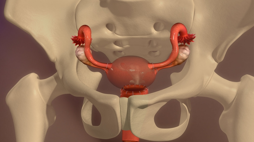 Vaginale Hysterektomie