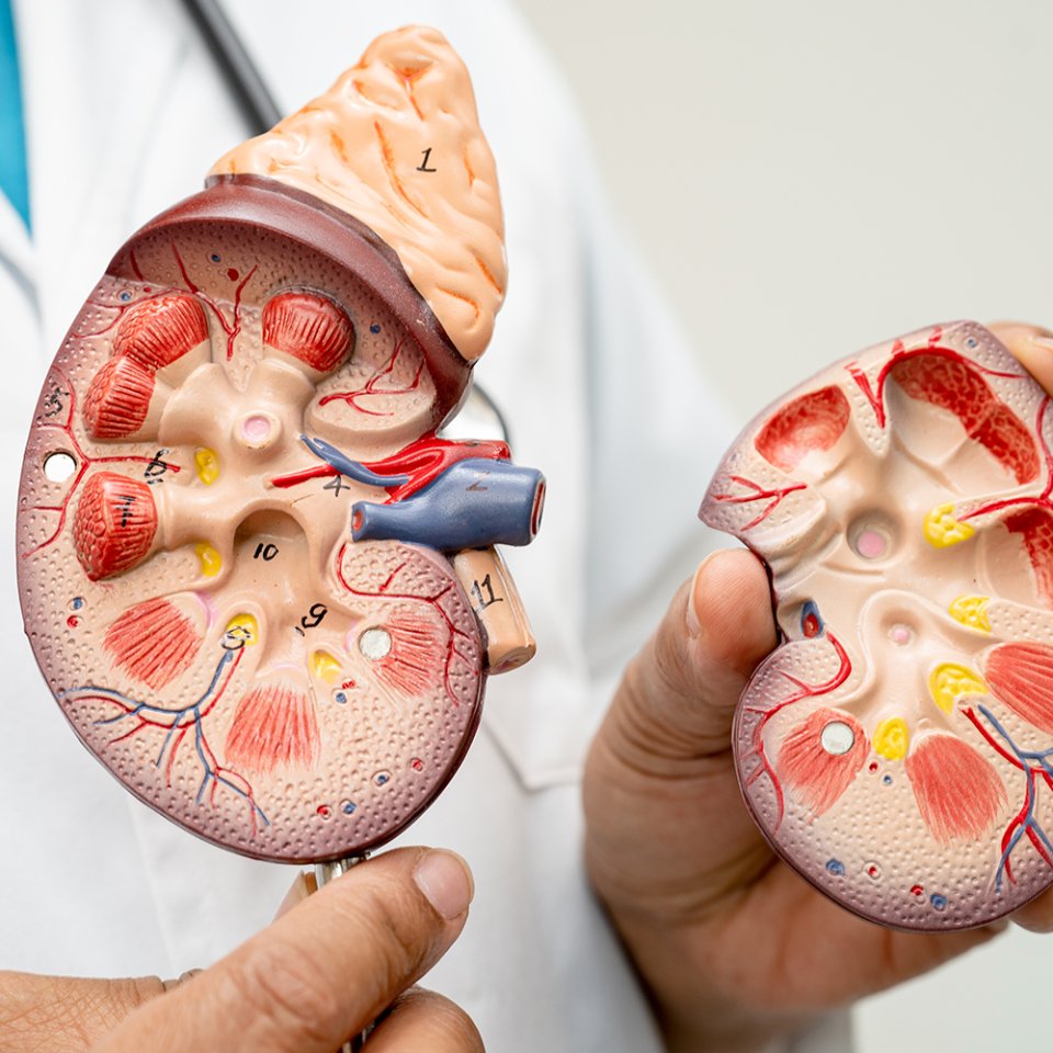 How is Laser Kidney Stone Surgery Performed?