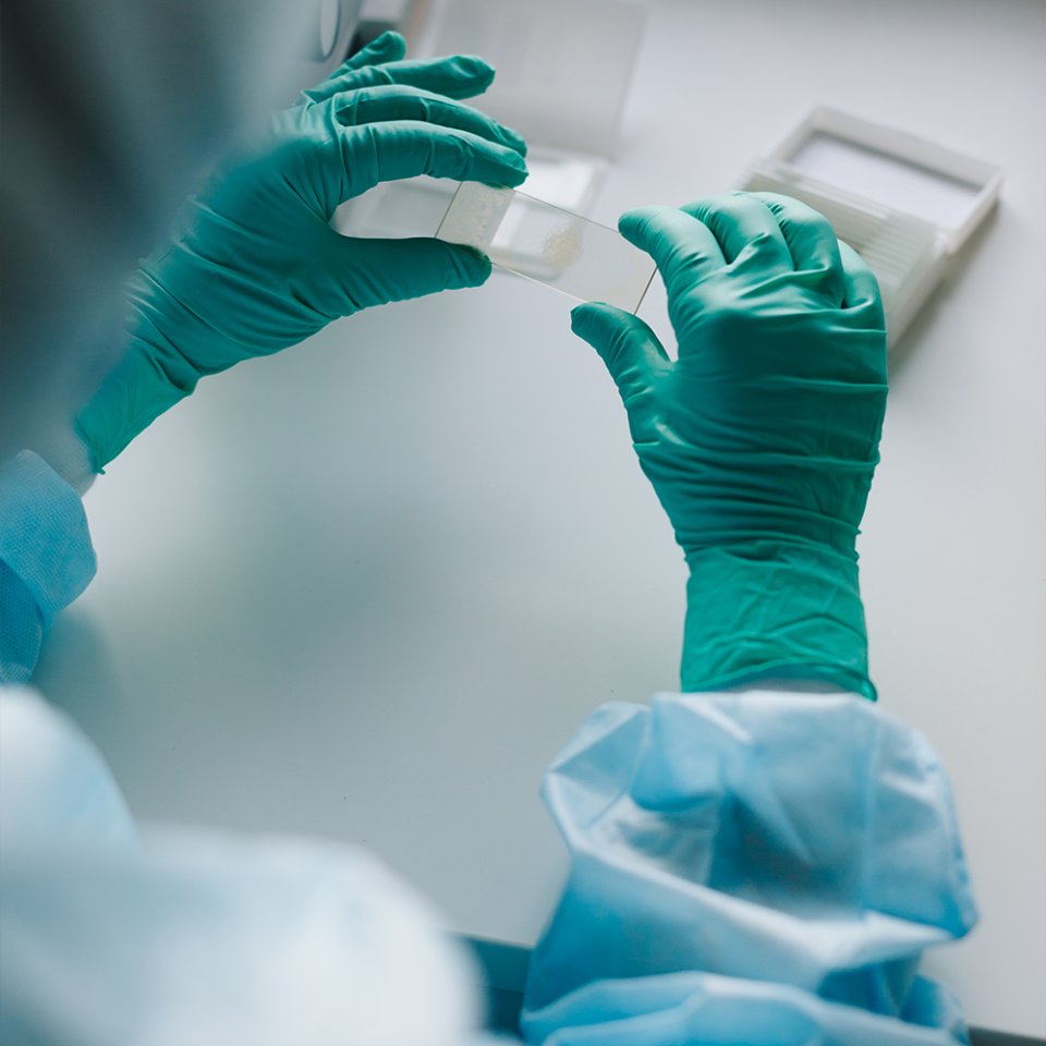 Comment la CRS est-elle réalisée ?