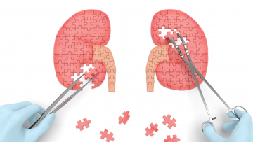 Kidney Tumors