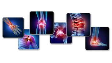 Bone and Joint Surgery