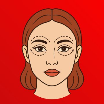 Göz Kapağı Estetiği (Blefaroplasti)
