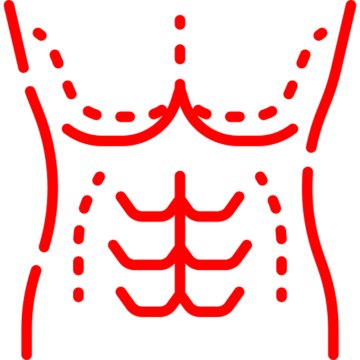 Гинекомастия