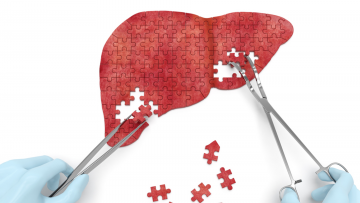 Liver Tumors
