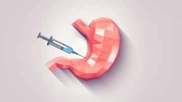 Ботокс для желудка