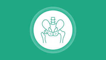 Andere Arthroplastiken