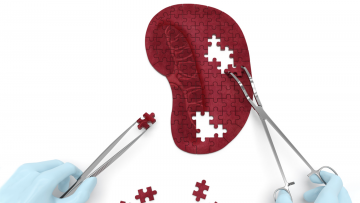 Spleen Tumors