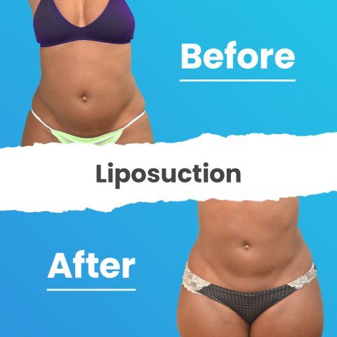 Vorher & Nachher image 1