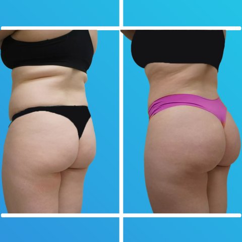 Vorher & Nachher image 1