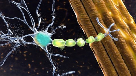 What is ALS? What are the stages and causes of ALS? image 1