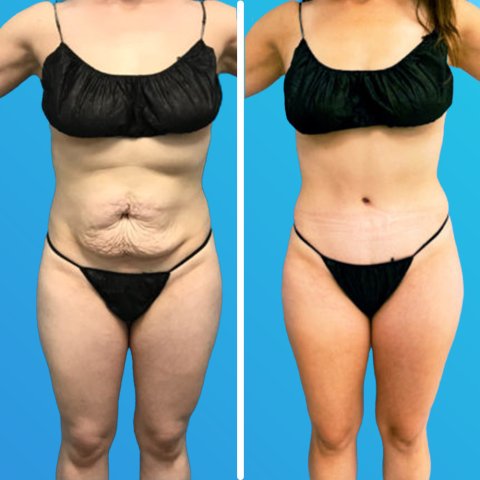 Vorher & Nachher image 1