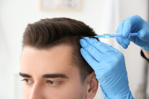 Hair Transplant in 20 Questions image 1