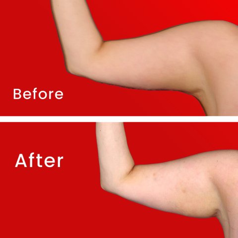 Vorher & Nachher image 1