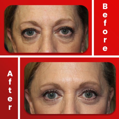 Vorher & Nachher image 1