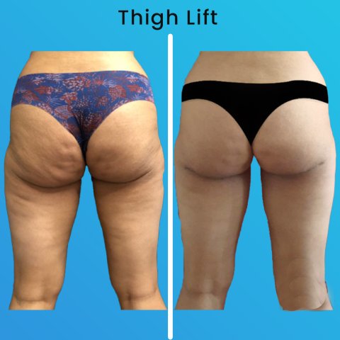 Vorher & Nachher image 1