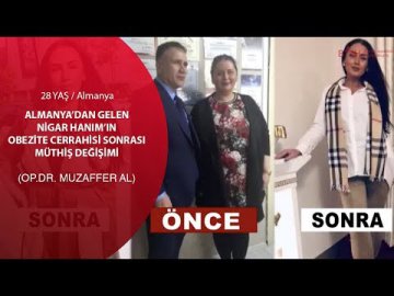 Awesome Change of Our Patient from Germany After Obesity Surgery